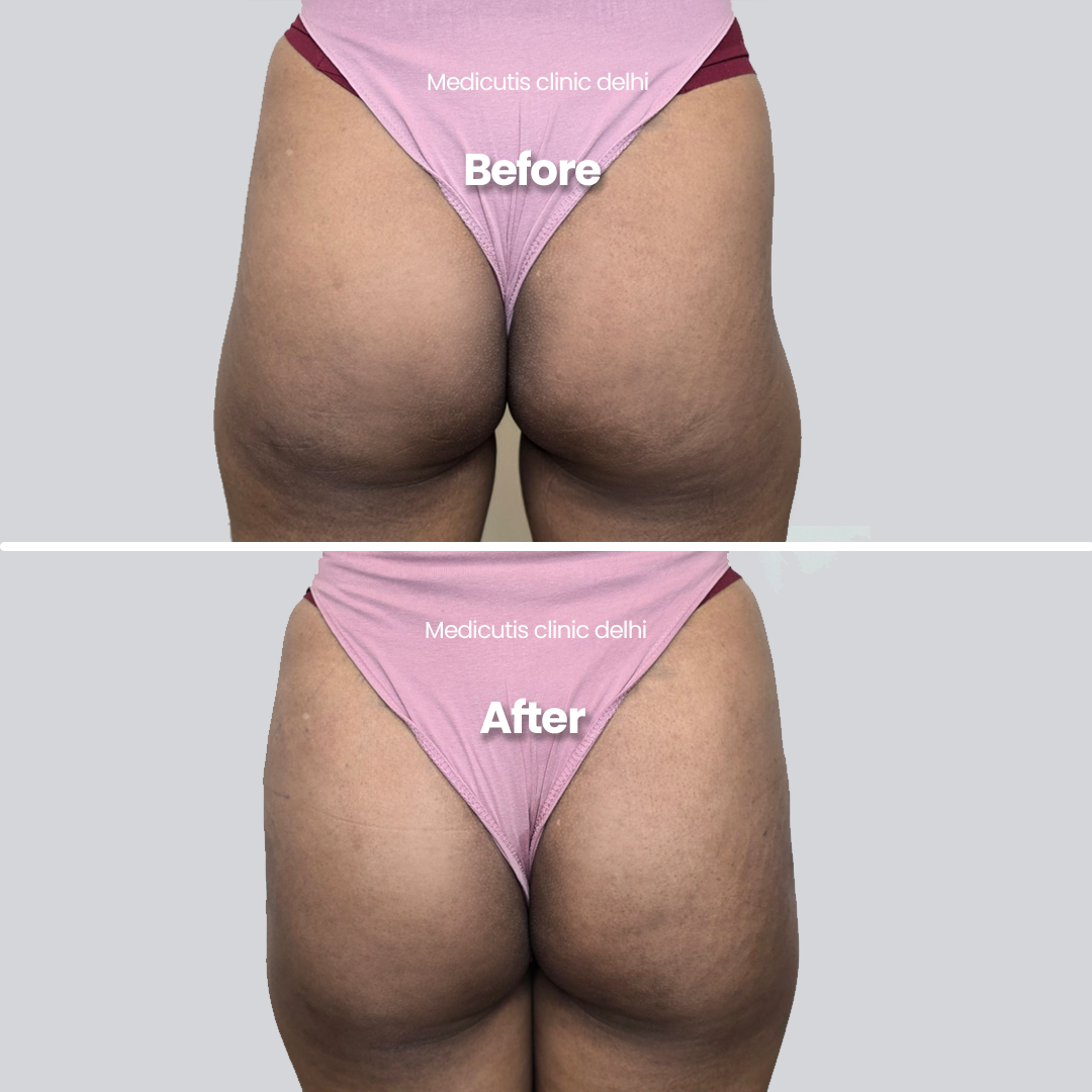 1 Body Sculpting & Slimming