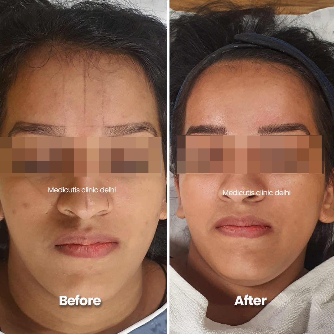 1 Permanent Make up