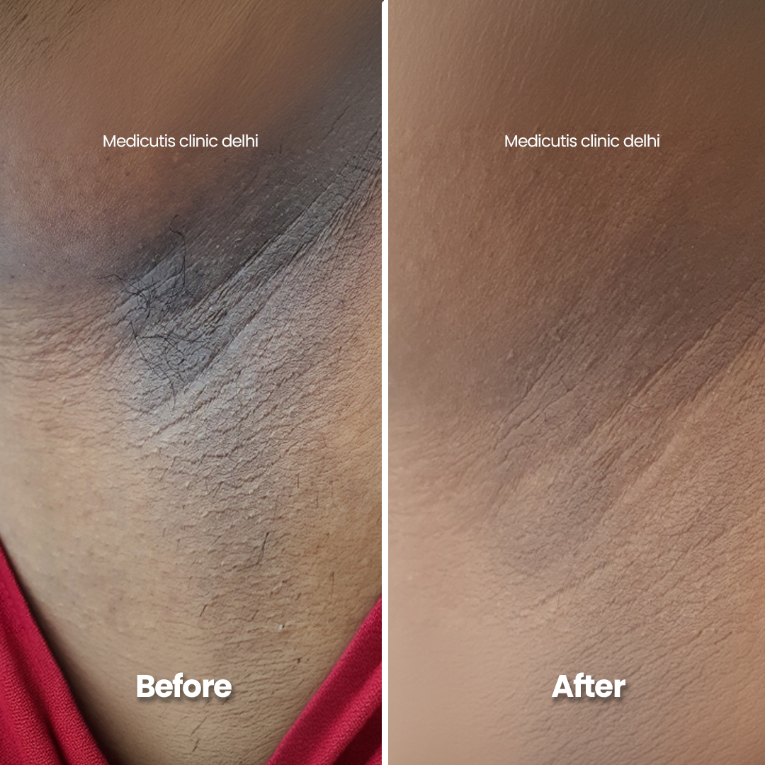 1 Pigmentation & Uneven Tone