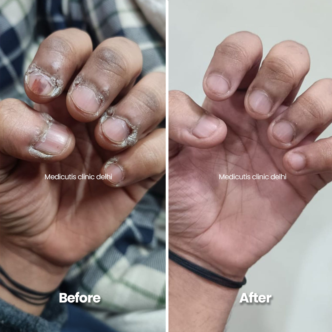 1 Skin Conditions