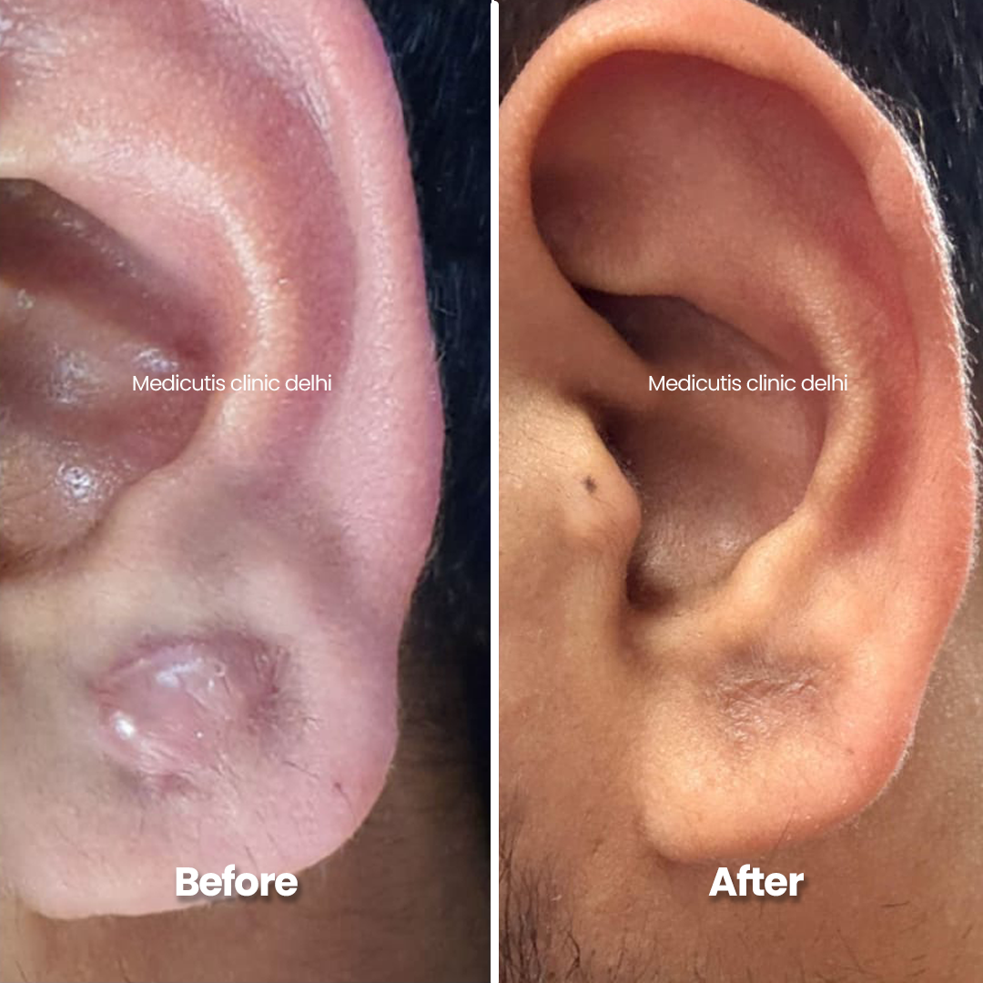 1 Surgical & Corrective