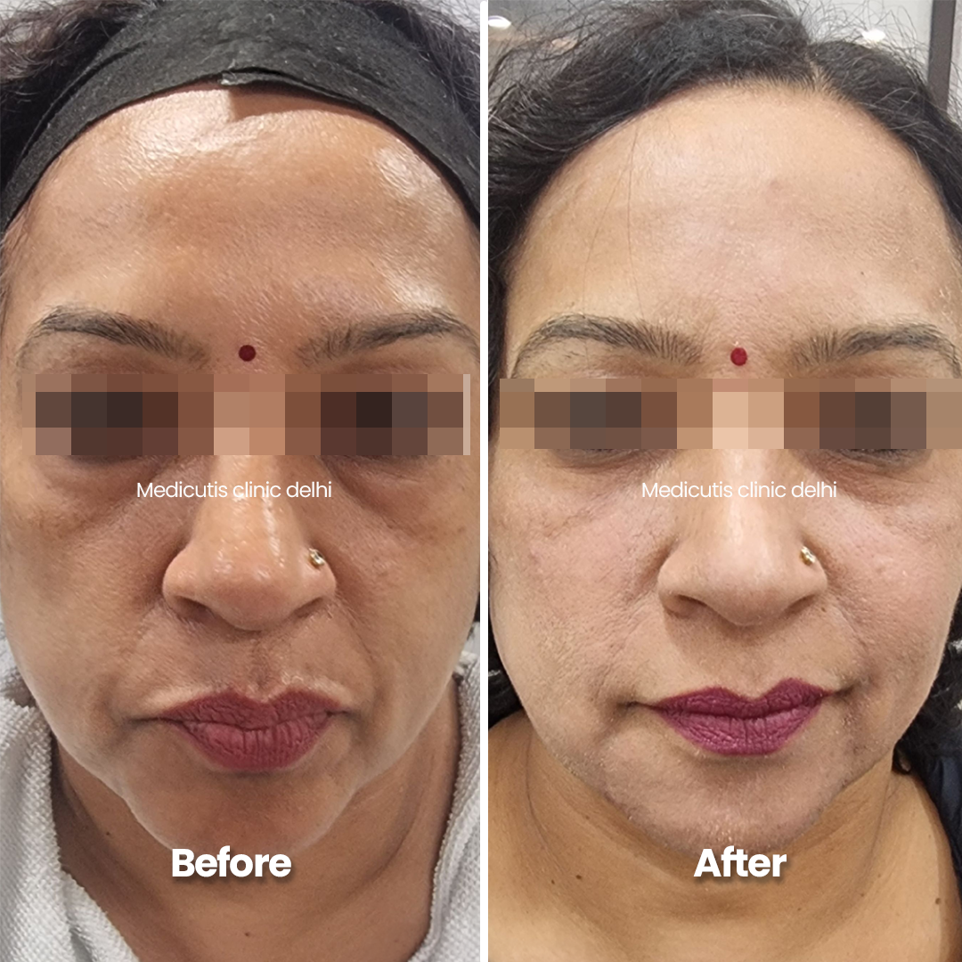 1 Under Eye Concerns
