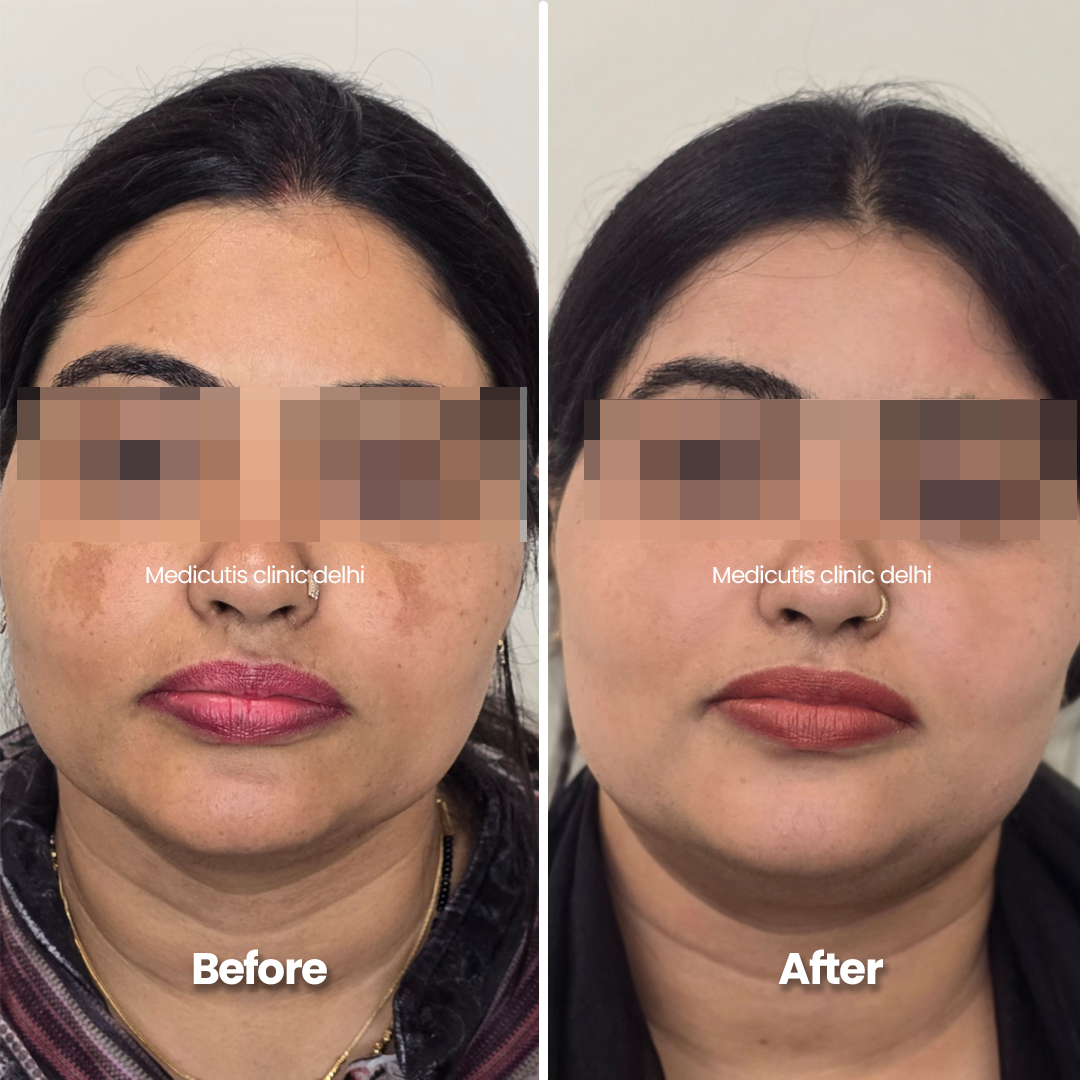 10 Pigmentation & Uneven Tone