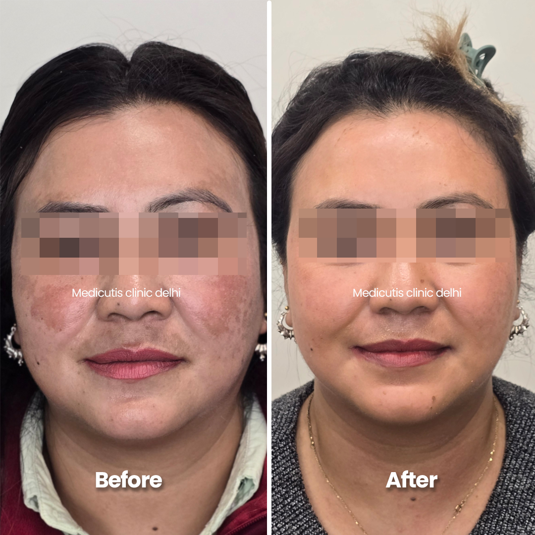 11 Pigmentation & Uneven Tone