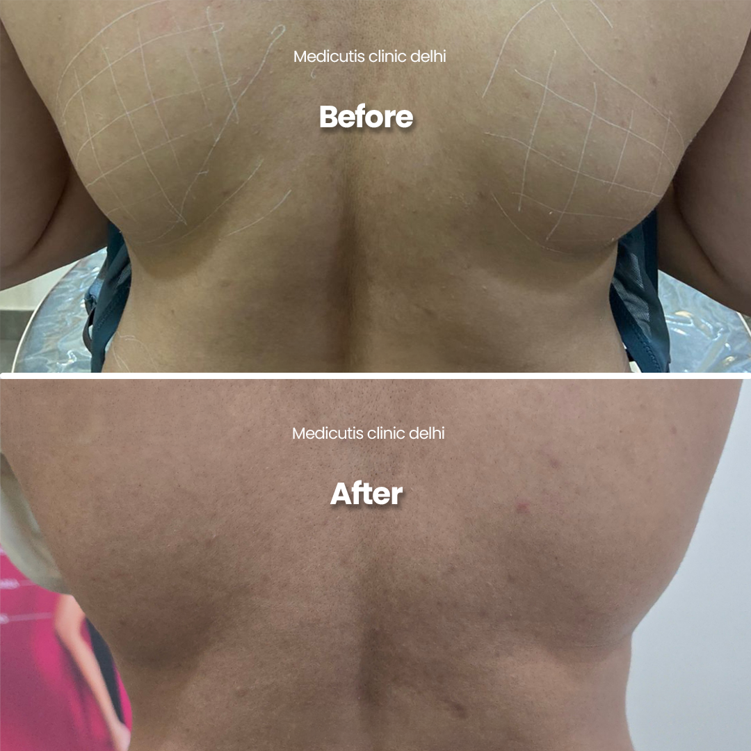 2 Body Sculpting & Slimming