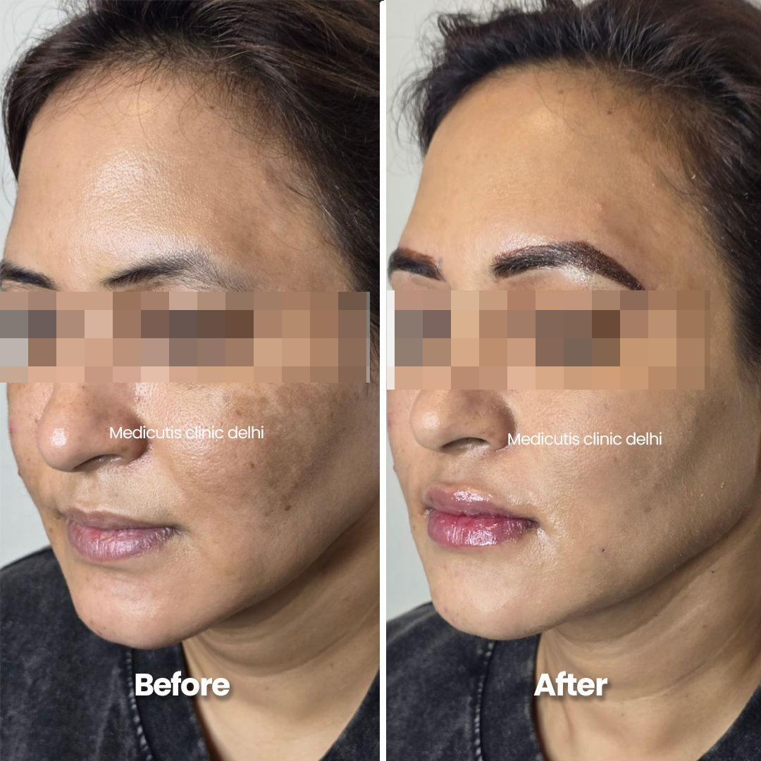 2 Permanent Make up