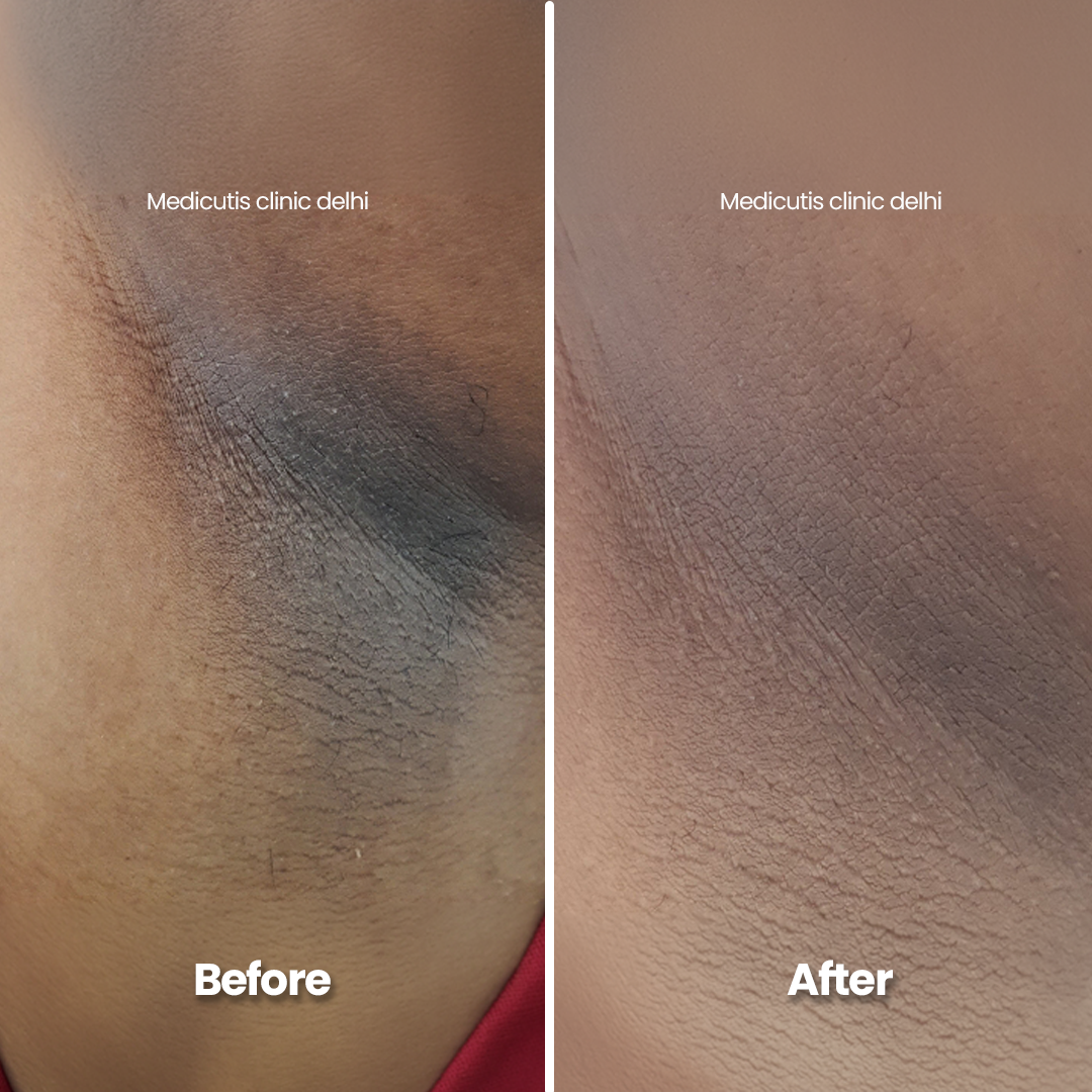 2 Pigmentation & Uneven Tone