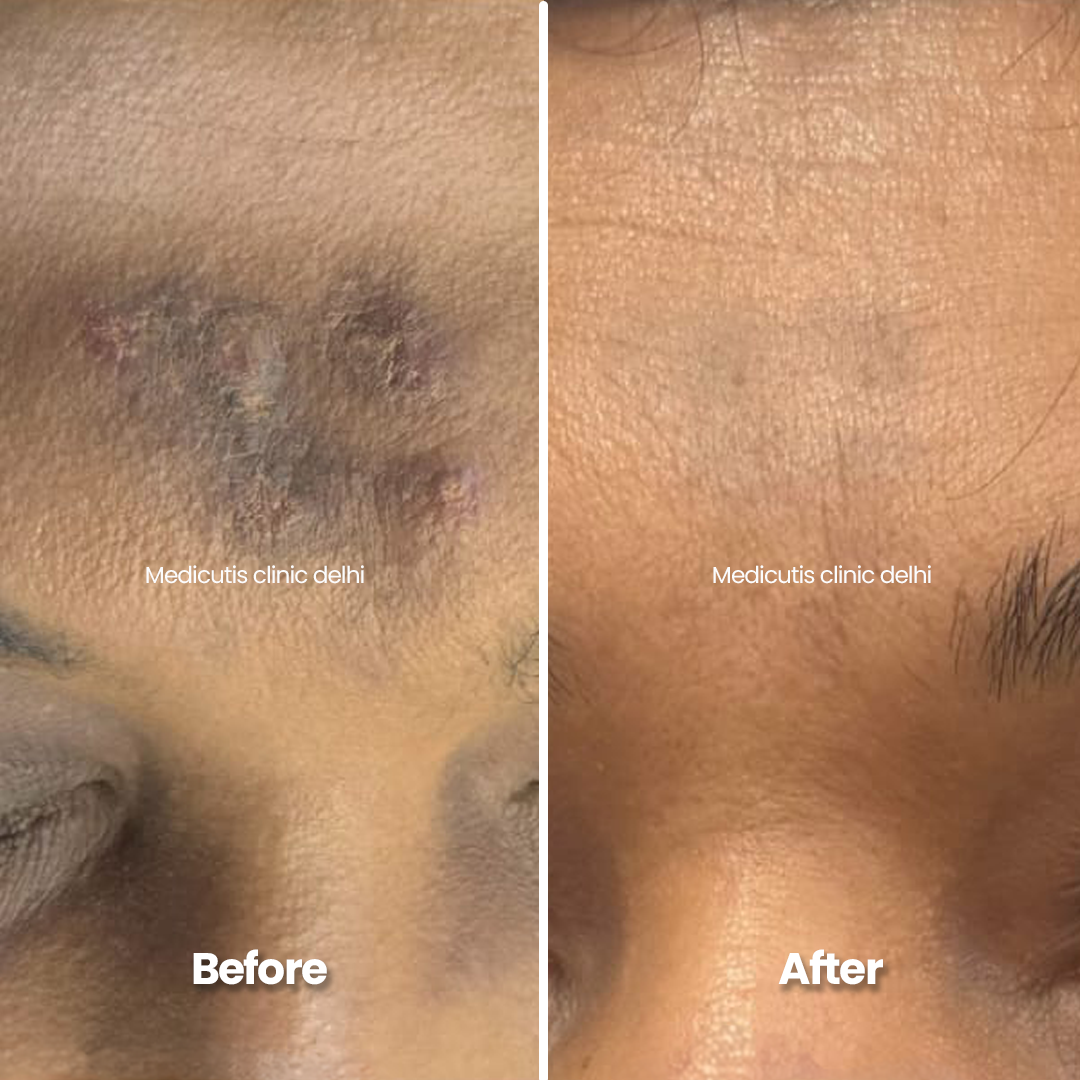 2 Skin Conditions