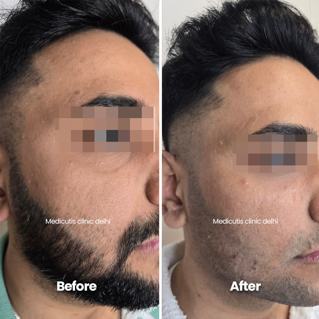 2 Under Eye Concerns