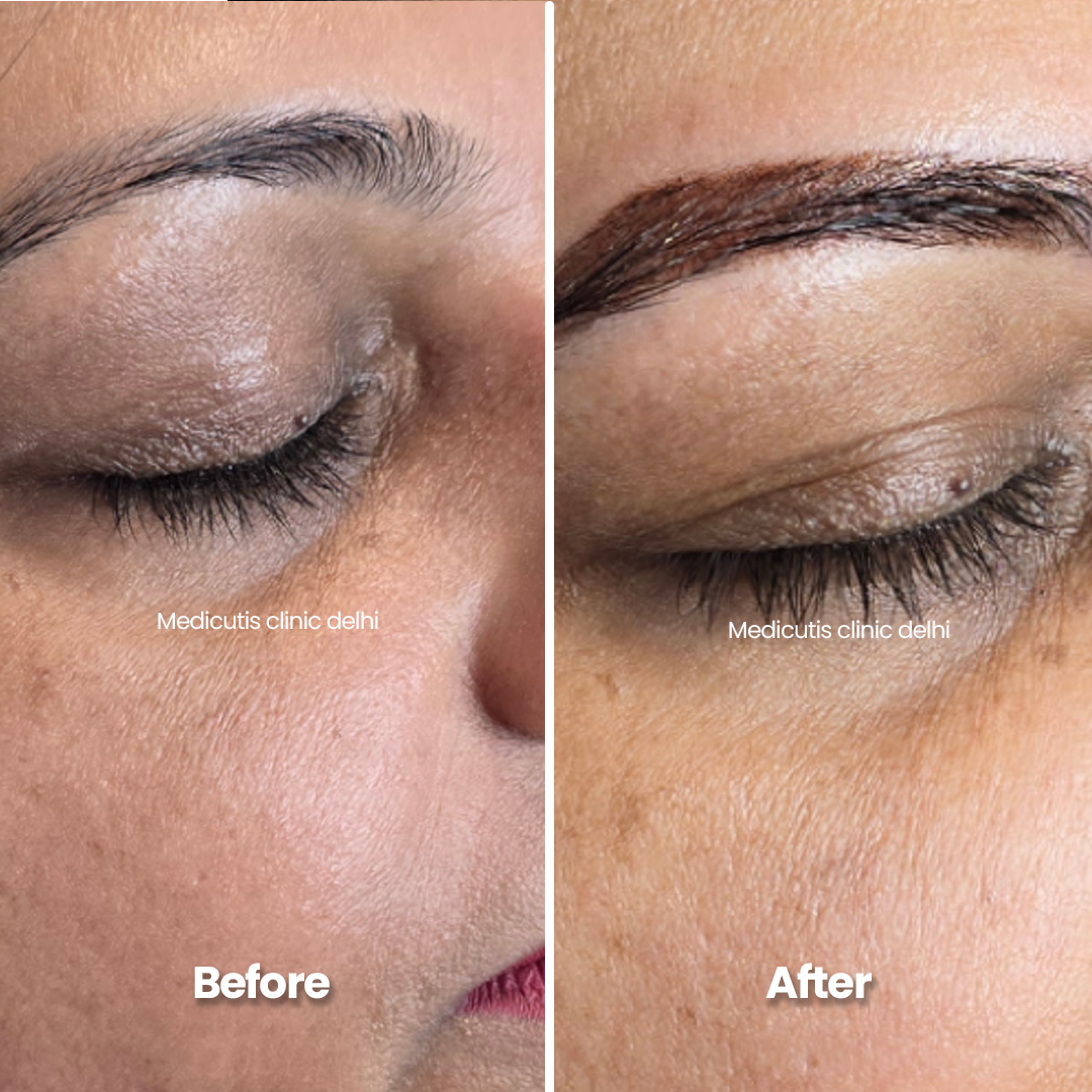 3 Permanent Make up
