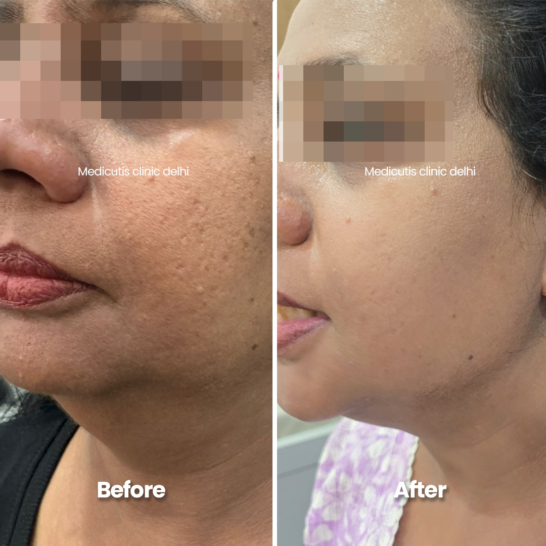 3 Pigmentation & Uneven Tone