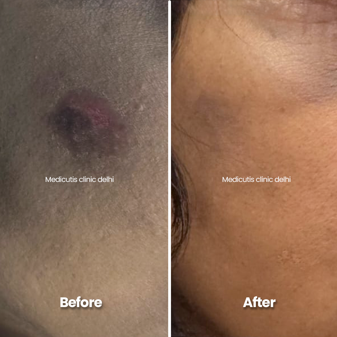 3 Skin Conditions