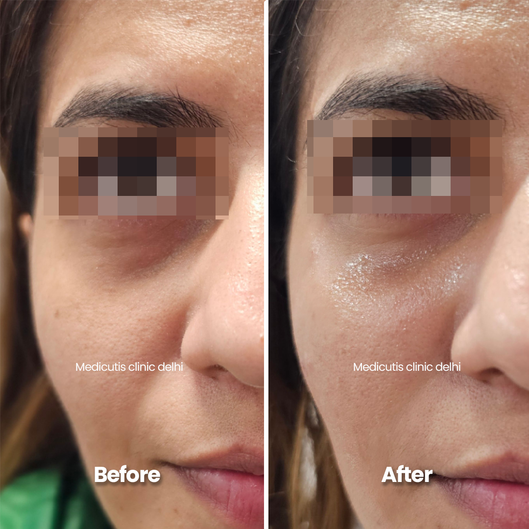 3 Under Eye Concerns