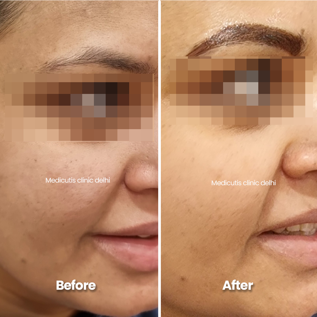 4 Permanent Make up