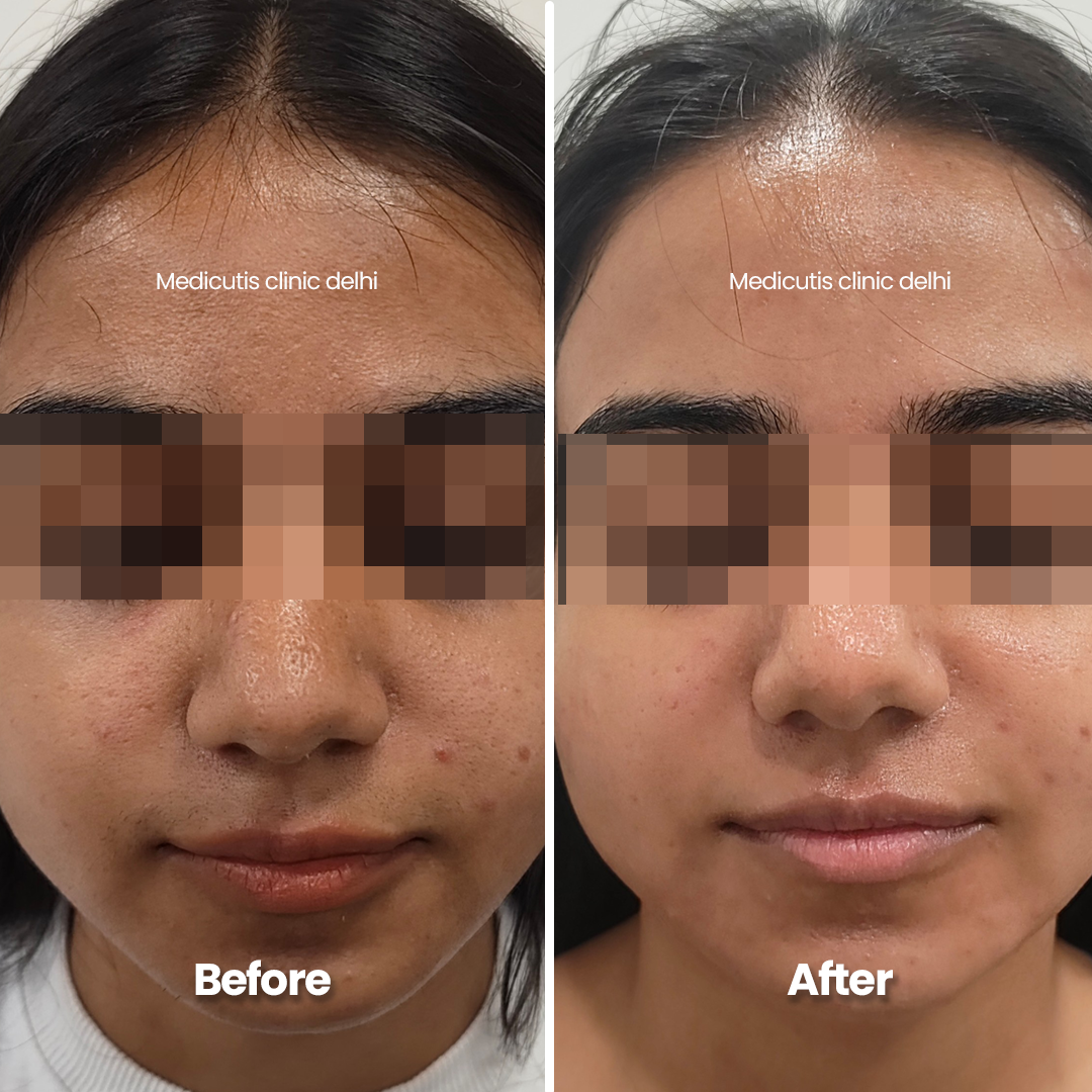 4 Pigmentation & Uneven Tone