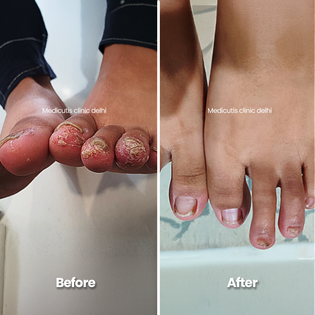 4 Skin Conditions