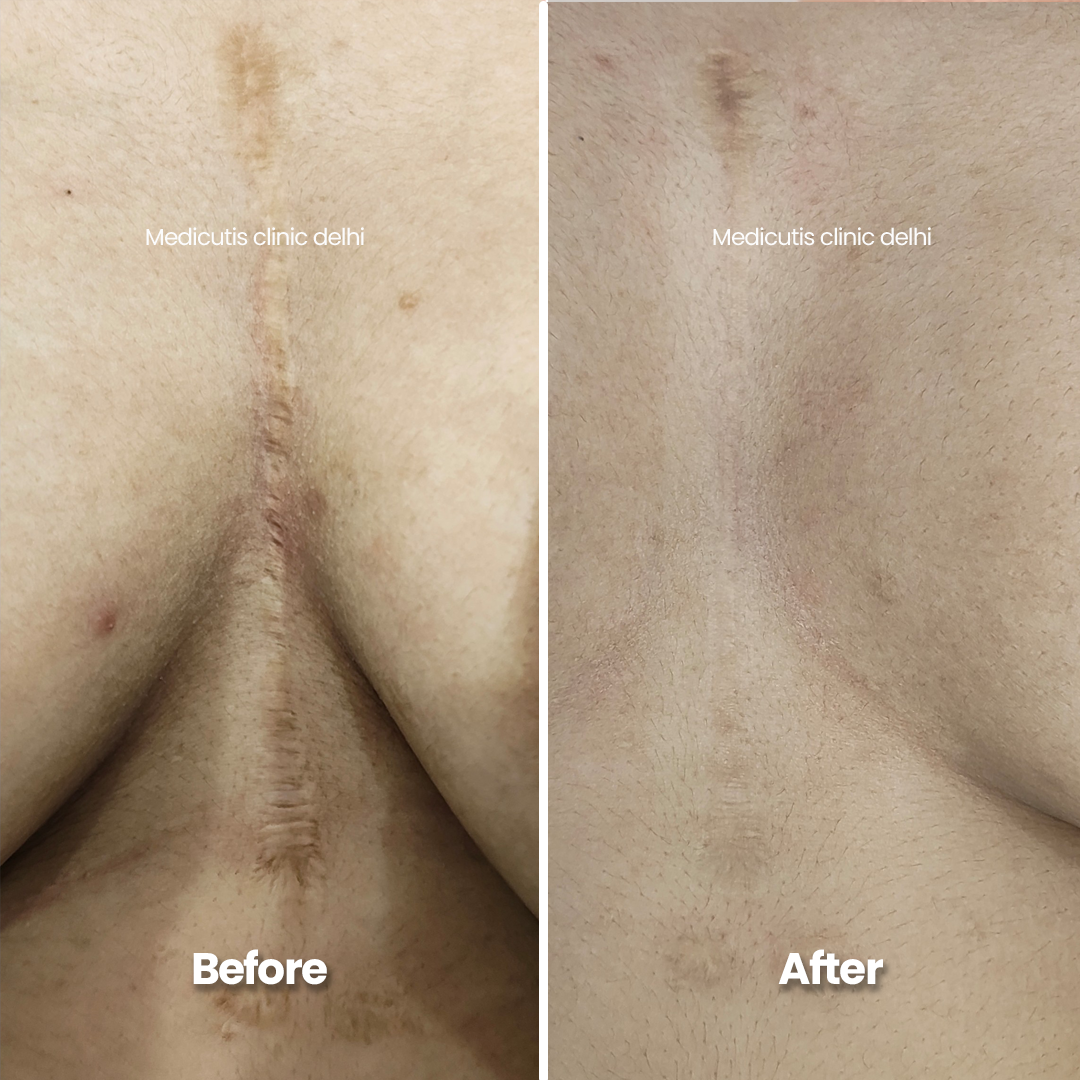4 Surgical & Corrective
