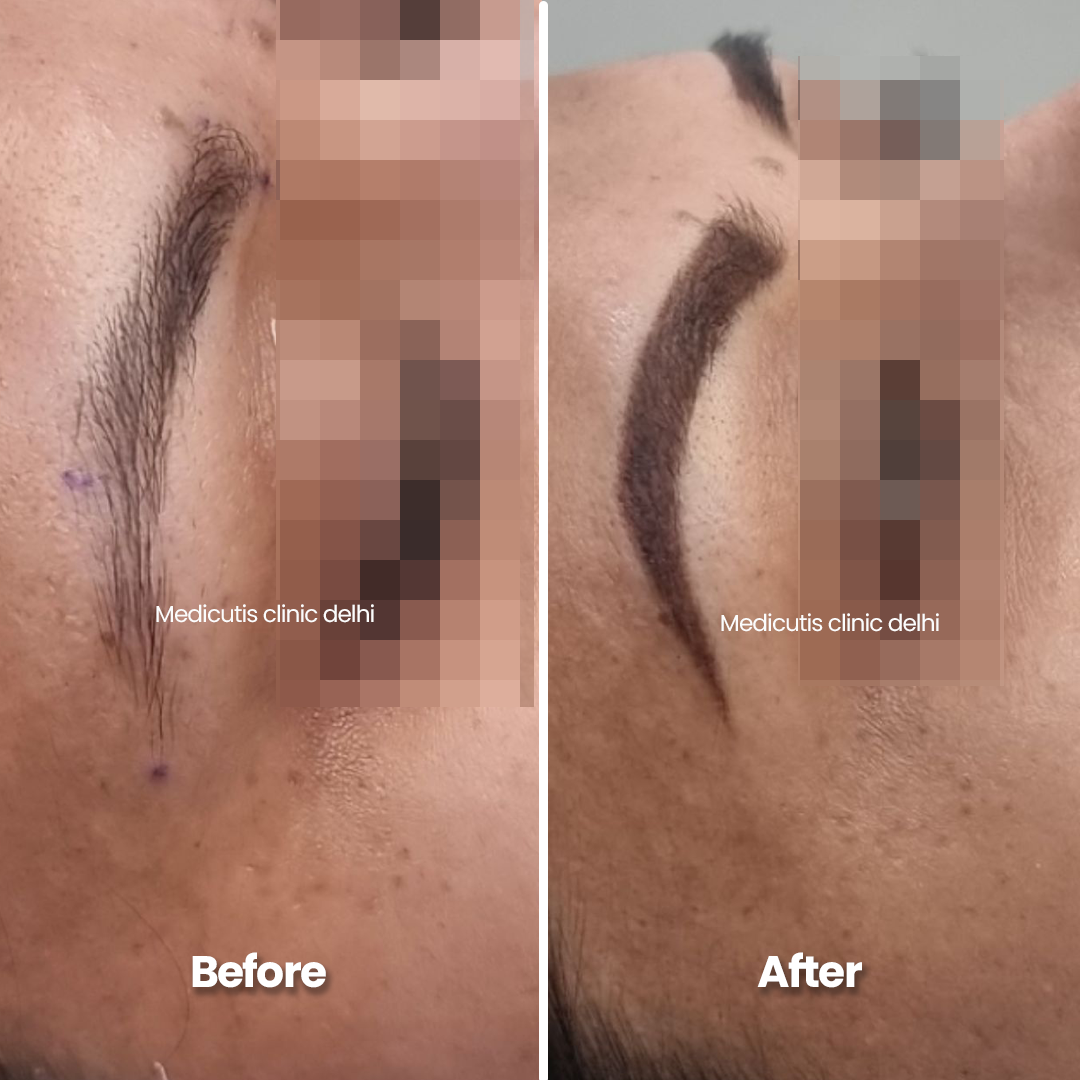 5 Permanent Make up