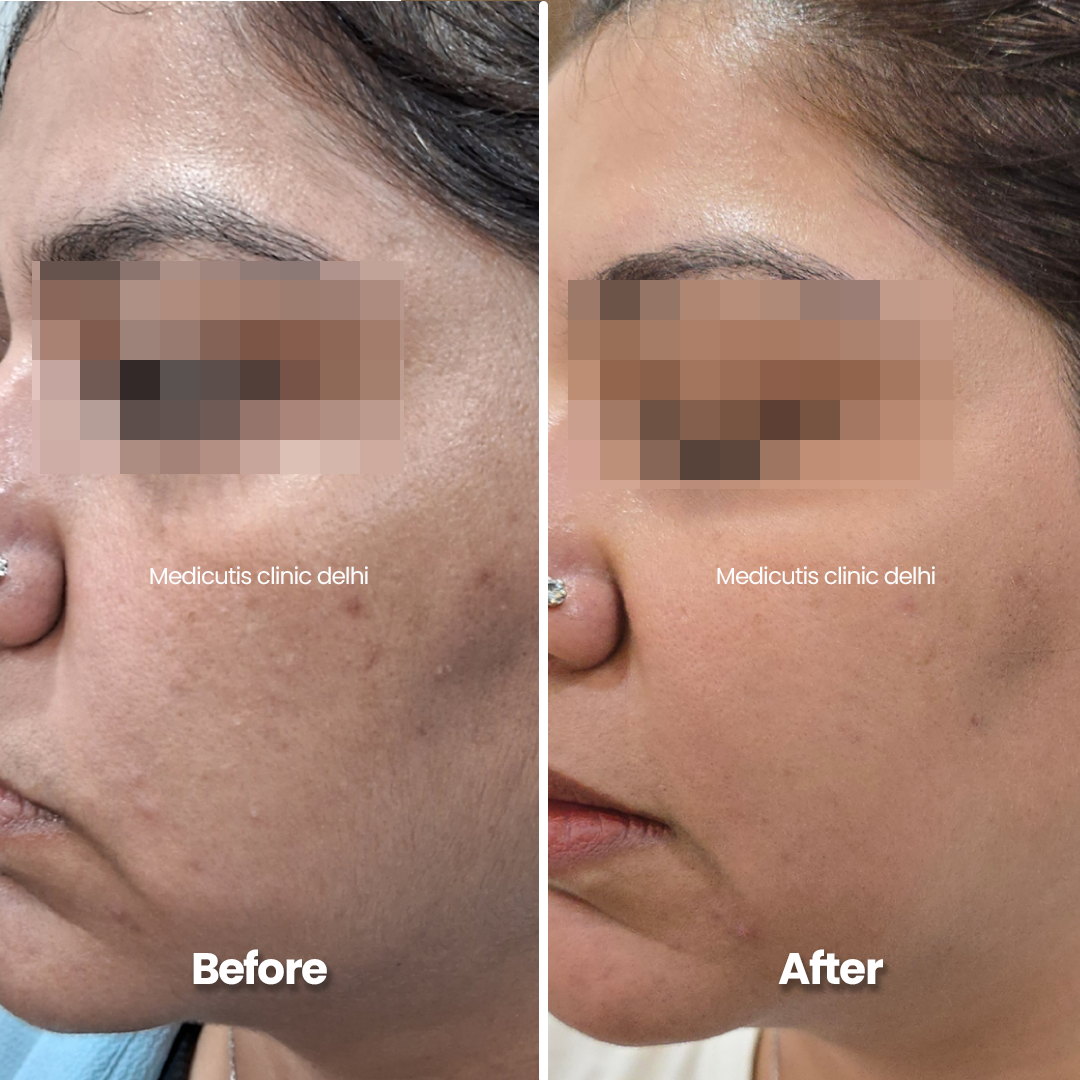 5 Skin Regeneration