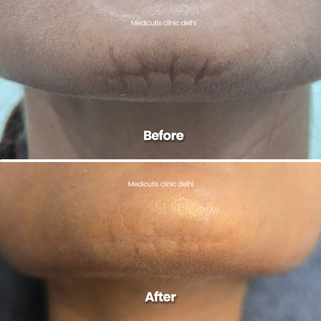 5 Surgical & Corrective