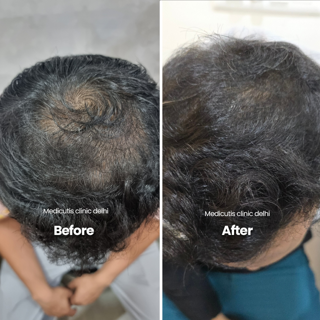 6 Hair Thinning