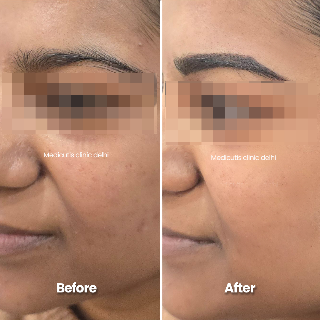 6 Permanent Make up