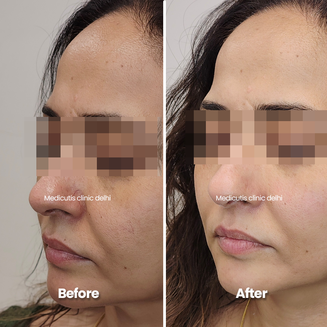 6 Pigmentation & Uneven Tone