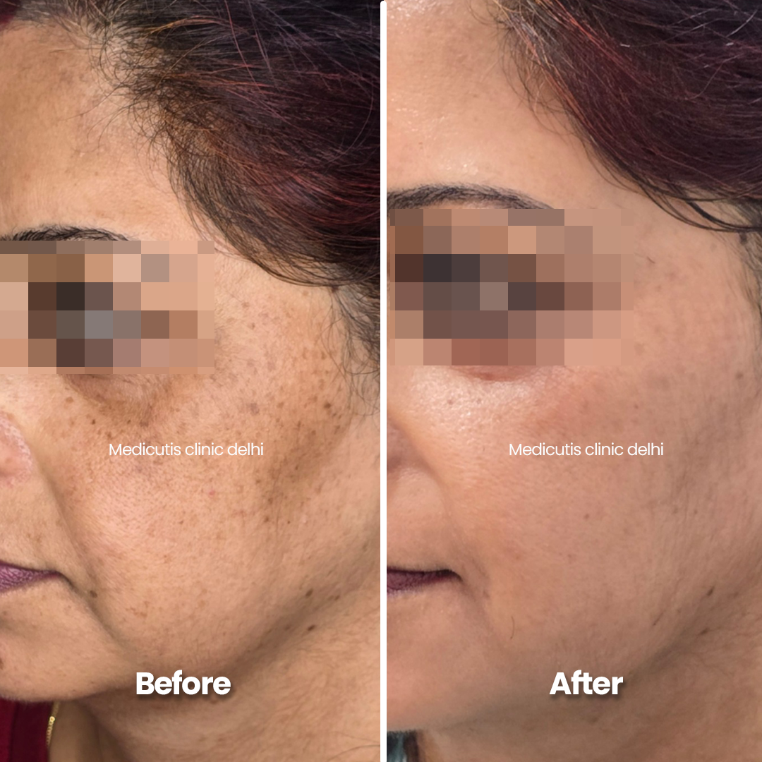 6 Skin Regeneration