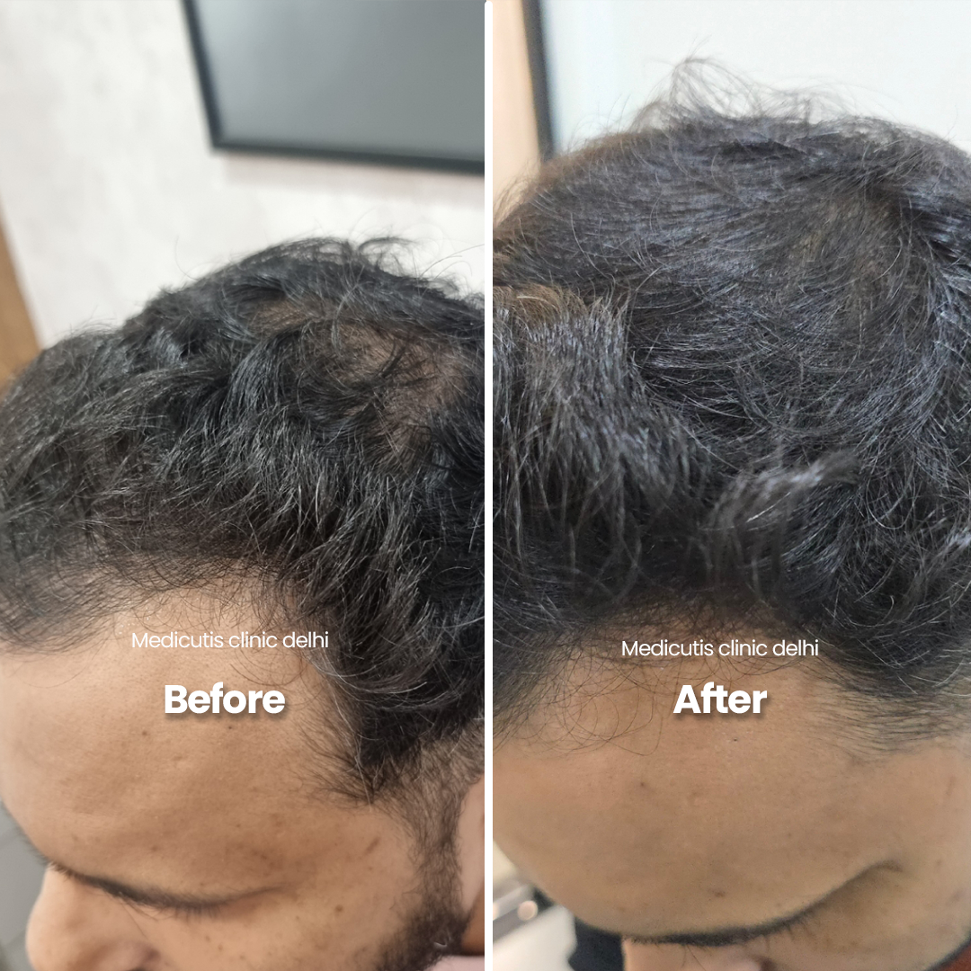 7 Hair Thinning