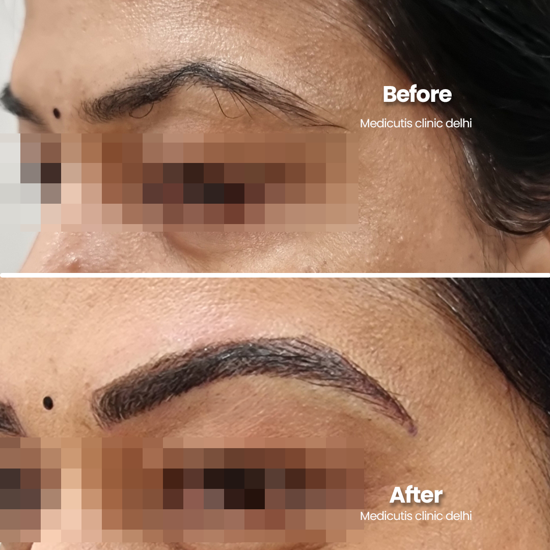 7 Permanent Make up