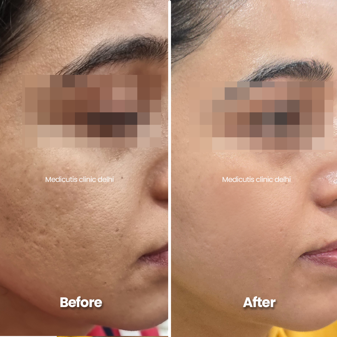 7 Skin Regeneration