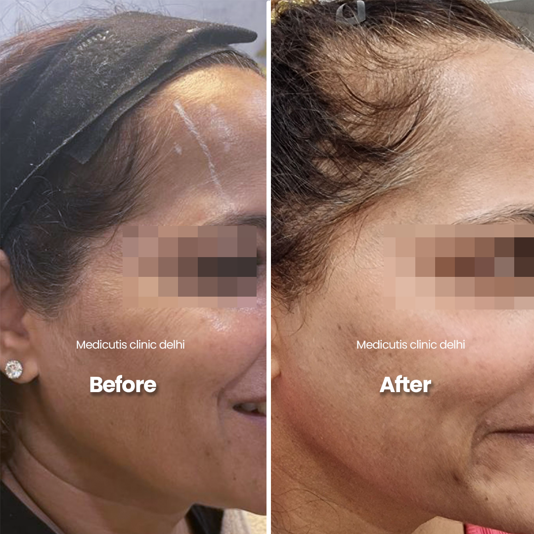 7 Wrinkles, Sagging & volume
