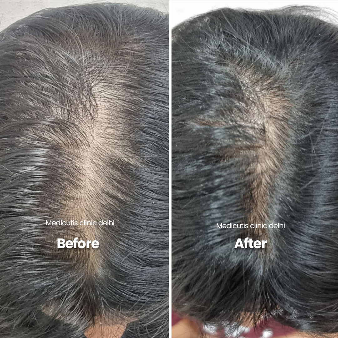 8 Hair Thinning