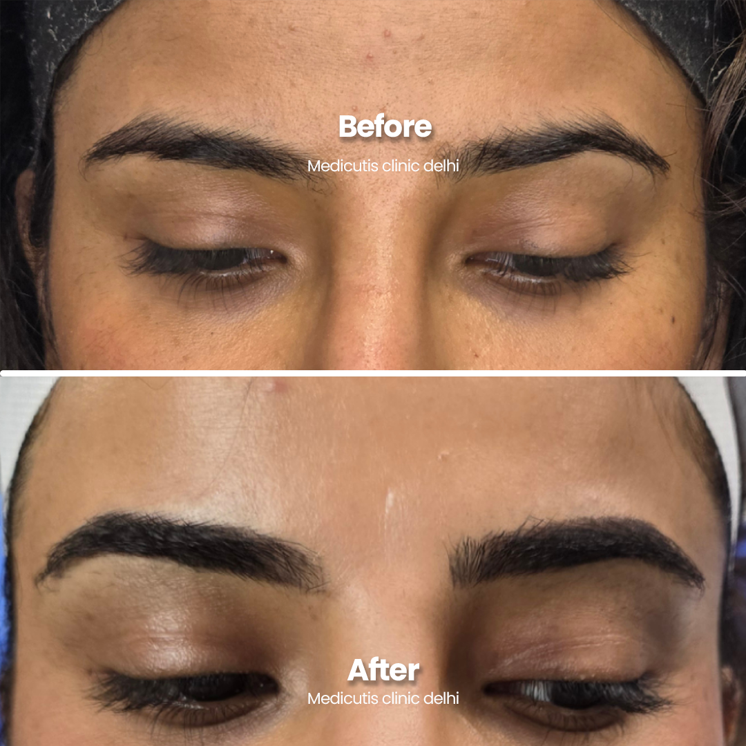 8 Permanent Make up