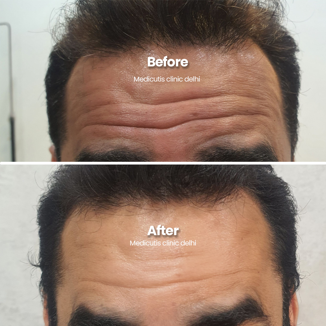 8 Wrinkles, Sagging & volume