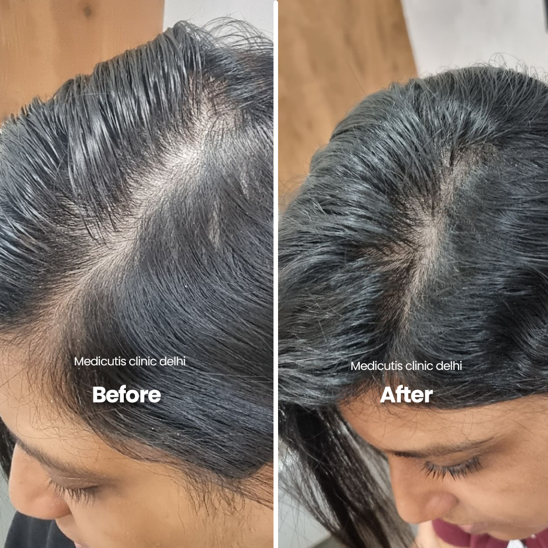 9 Hair Thinning