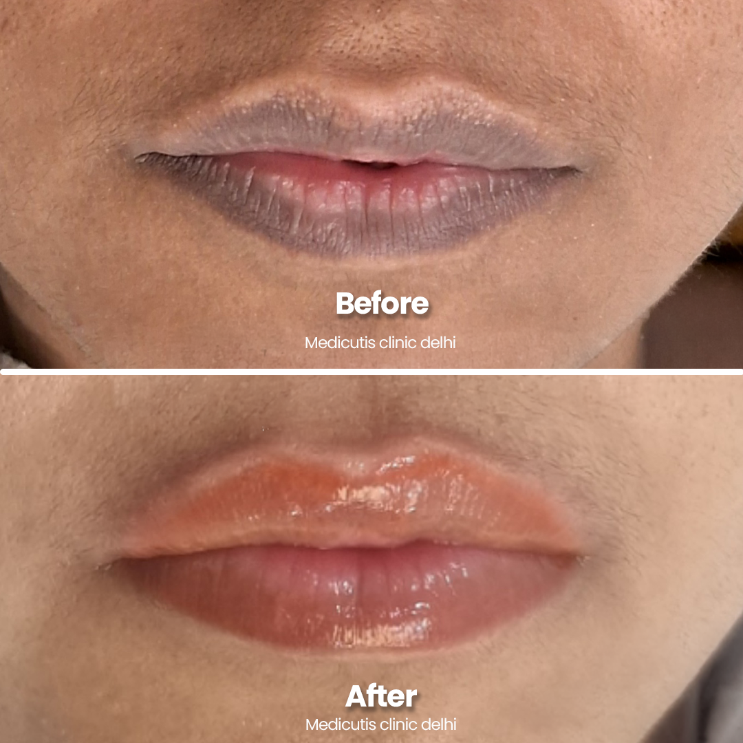 9 Permanent Make up